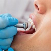 Tratamento dentário Tratamento dentário